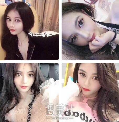 石家庄,美联臣,双眼皮