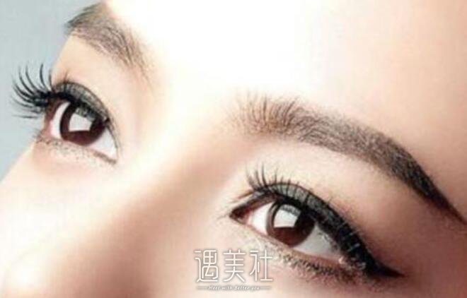 北京埋线双眼皮修复一般多少钱?哪个区间合理?