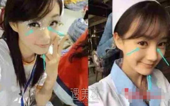 李一桐整容前后照片曝光?李一桐整容实锤了吗?