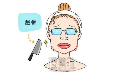 调节下颌角肥胖
