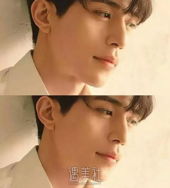 李东旭整容前后