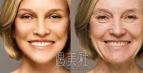 像素射频除皱