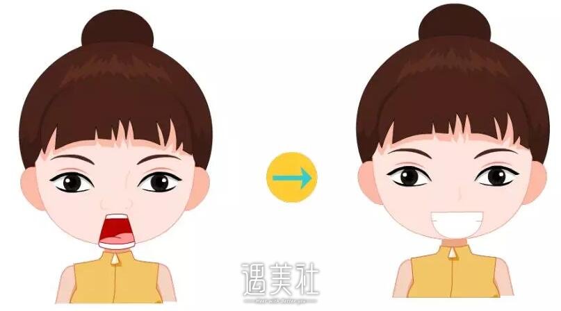 鼻尖肥大整形
