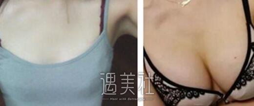李咏红