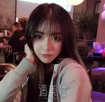 鼻孔缩小