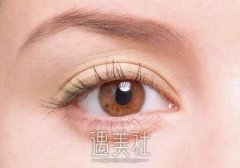 北京割双眼皮哪里好？选择医院要参考哪些因素呢？ width=