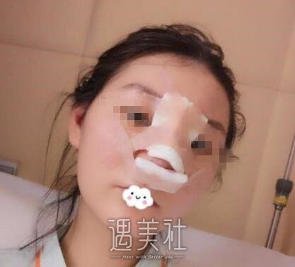 任贝贝医生怎么样?任贝贝崭新案例火爆上线啦~