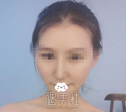 任贝贝医生怎么样?任贝贝崭新案例火爆上线啦~