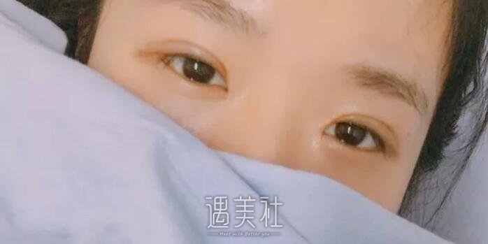 张冰洁整形医生怎么样?有张冰洁整形案例看看吗?