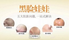 黑脸娃娃做几次有果?还是只需要做一次? width=