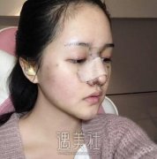 李劲良在哪家医院？全新简介+鼻部修复案例来袭 width=