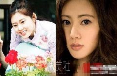 秋瓷炫整容前后对比照片疑似曝光，竟是后天美女? width=