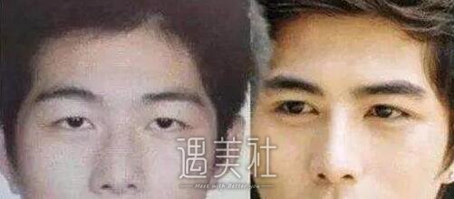 陈学东整容前后