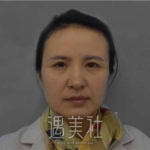 微针除皱