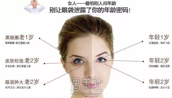 北京超声法去眼袋