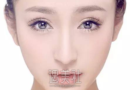 不适合开眼角眼型图片|哪些眼型不适合开眼角呢?