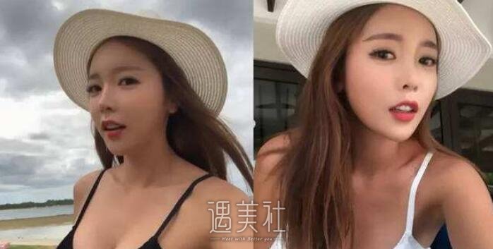 洪真英整容前后乃天壤之别，洪真英整容算石锤了?