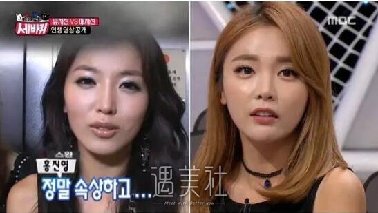 洪真英整容前后乃天壤之别，洪真英整容算石锤了?