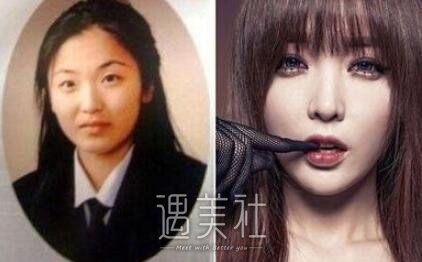 洪真英整容前后乃天壤之别，洪真英整容算石锤了?