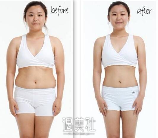 合肥聚能吸脂减肥怎么收费的?多少钱比较合理喃?