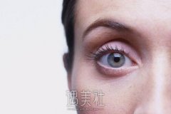 梅州上睑皮肤松弛矫正手术一般多少钱？俺很想了解！ width=