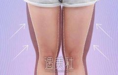 襄樊整酒窝大概需要多少钱？书上没有找到答案捏？ width=