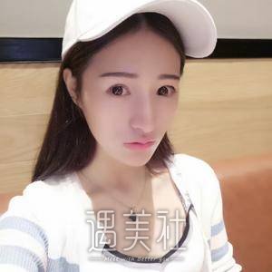 下颌角磨骨整形
