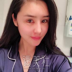 双眼皮修复手术