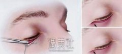 九院去眼袋手术价格表|九院去眼袋收费贵吗？ width=