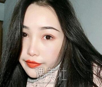 福州,武警整形,注射瘦脸