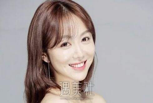 姜妍整容
