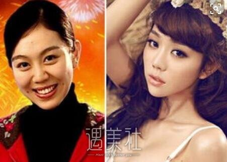 姜妍整容