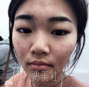 煤炭总医院,史芳,嫩肤