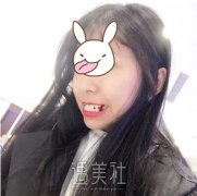佳美口腔医院价格表，附牙齿矫正案例一则给大家参考! width=