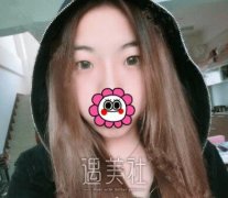 石家庄美联臣做了双眼皮，走到哪都是我的舞台！ width=