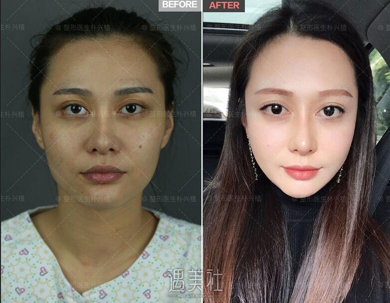 朴兴植