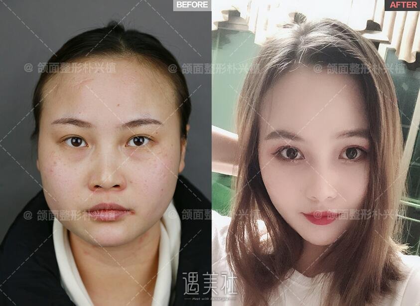 朴兴植