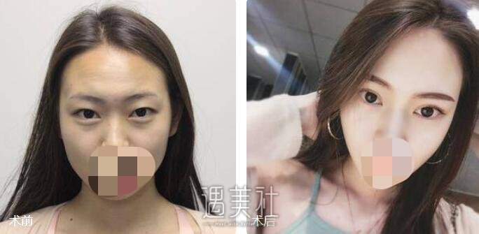 首尔丽格