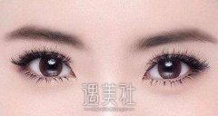 北京埋线双眼皮修复价格多少比较合理?怎样的收费标准? width=