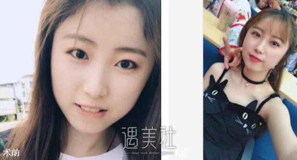 北京美联臣整形医院