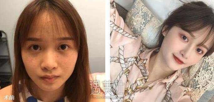 北京美联臣整形医院