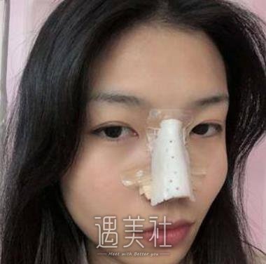 广州,曙光,王旭明,做鼻子