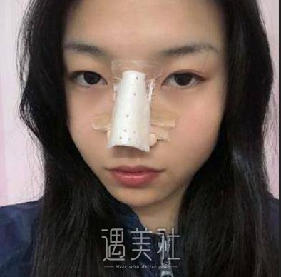 广州,曙光,王旭明,做鼻子