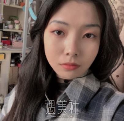 广州,曙光,王旭明,做鼻子