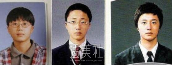 丁一宇整容