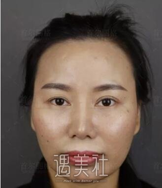 首尔丽格,朴兴植,凸嘴矫正