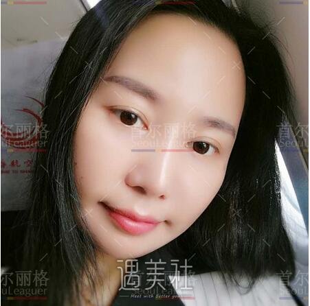 首尔丽格,朴兴植,凸嘴矫正