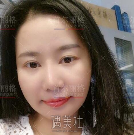 首尔丽格,朴兴植,凸嘴矫正