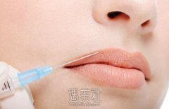玻尿酸丰唇多久能消肿? 怎么护理消肿能快些喃? width=