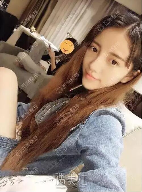 胶原蛋白隆鼻术果到底好不好|胶原蛋白隆鼻术案例力证~